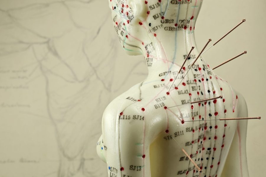 A human medical figurine with acupuncture needles inserted into marked Qi meridien acupoints